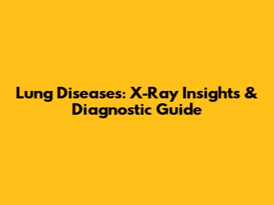 Lung Diseases: X-Ray Insights & Diagnostic Guide
